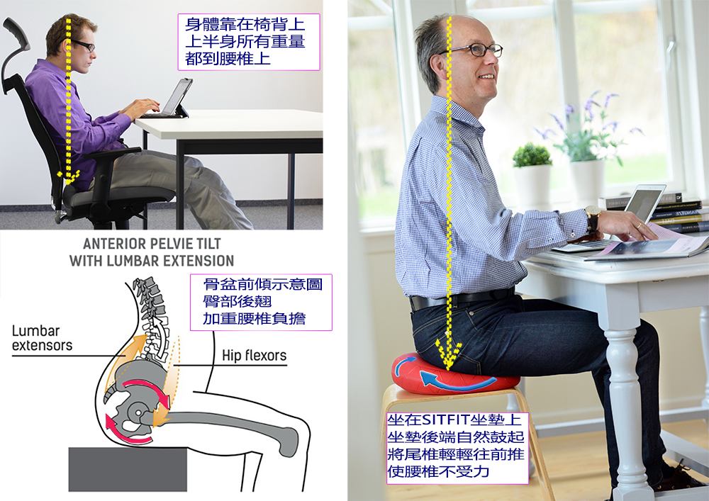 核心鍛煉 坐姿矯正 骨盆前傾 腰痠背痛 下背痛 坐骨神經痛 美姿美儀